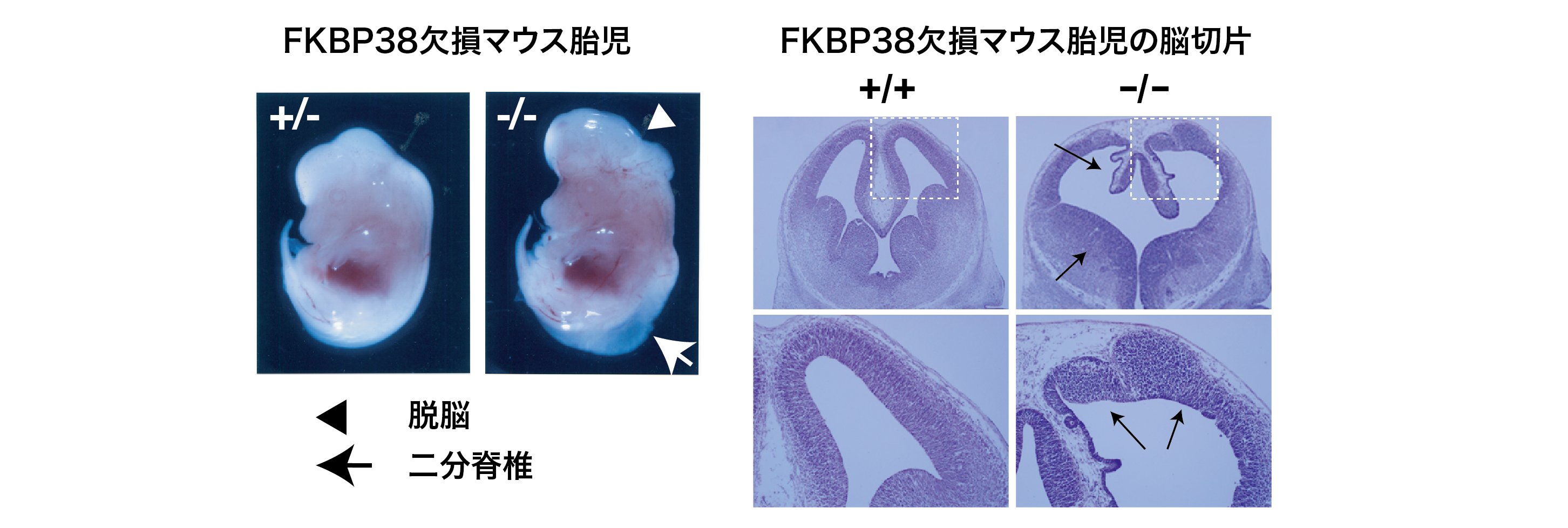 図9　FKBP38-KO mice。